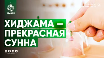 Хиджама — прекрасная сунна | Azan.ru