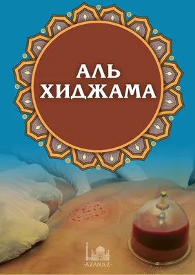 Хиджама при гипертонии | Авиценна Хиджама | Дзен