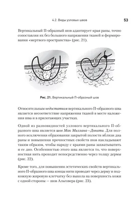 Хирургический набор для наложения швов / Хирургический тренажер /  Медицинские инструменты купить по цене 3990 ₽ в интернет-магазине  KazanExpress