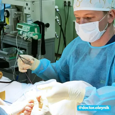 Пластический хирург Гущина Анастасия Олеговна - ❗️ШОВ ПОСЛЕ ОПЕРАЦИИ❗️ ▪️На  данном фото вы видите внутрикожный шов сразу после операции. Узелки сбоку  нужны для укрепления шва на изгибе, т.к натяжение в этом месте