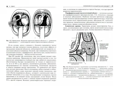 Иллюстрация 1 из 3 для Хронический тонзиллит - Крюков, Кунельская, Царапкин  | Лабиринт - книги. Источник: Лабиринт
