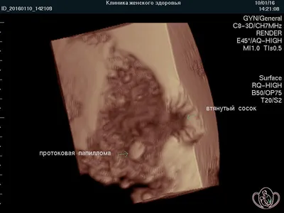 BI-RADS — исследование молочных желез — 24Radiology.ru