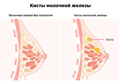 БУЗ ВО \"Кантемировская РБ\"