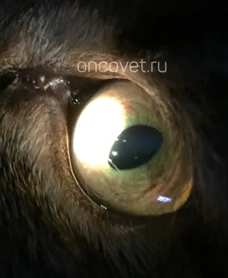 ✳️ ️ Операции на глазах ✳️ ️ Хирургическая офтальмология в медицинском  центре «RISHON» - Офтальмохирургия