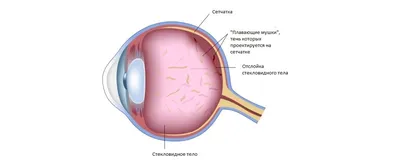 Повышенный холестерин можно увидеть по глазам - фото | РБК Украина