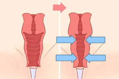 Интимное восстановление после родов