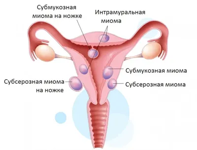 5 фактов о липофилинге ягодиц⠀