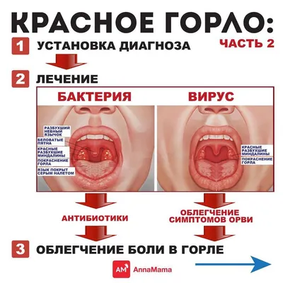 ВПЧ: рак горла, рак гортани, головы, шеи и языка - 16 и 18 тип у женщин и  мужчин