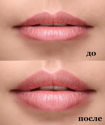 Антиэйдж процедуры в 30+: что делать? | Beauty Insider