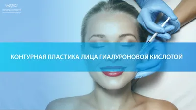 Контурная пластика (увеличение) губ в СПб филерами, гиалуроновой кислотой