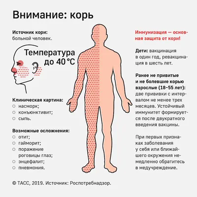 Корь у детей: Вспышка кори в России в 2023 году 🤒 - Евромед Кидс