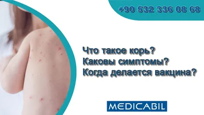 ПРОФИЛАКТИКА КОРИ