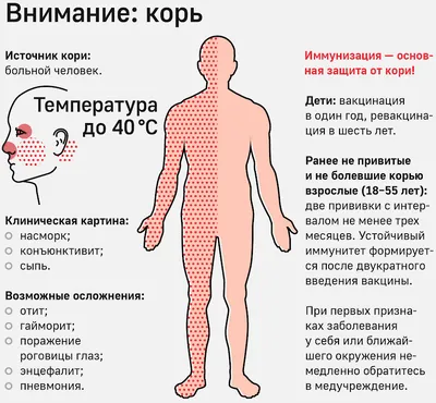 Врачи бьют тревогу: в Алматы нестабильная ситуация по заболеваемости корью