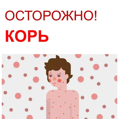 Корь и её профилактика