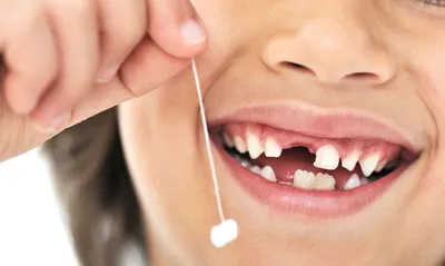 Удаление молочных зубов без боли