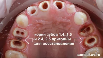 Особенности строения человеческих зубов