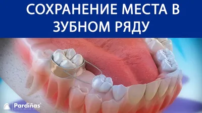 Удаление молочных зубов - Профессорская стоматологическая клиника