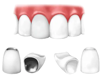 Циркониевые коронки, цена в Москве на диоксид циркония, коронки цена на  циркониевые коронки на передние зубы, стоимость коронки из циркония, цена в  Москве