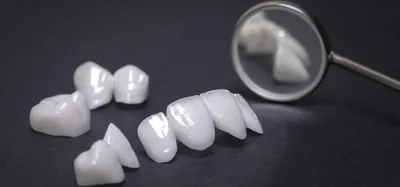 Циркониевые коронки на зубы ᐉ Цены зубных коронок из диоксида циркония в  Калининграде