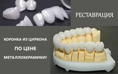 3 коронки из диоксида циркония на центральные зубы дополнили эстетику  керамики - Немецкий имплантологический центр, Москва