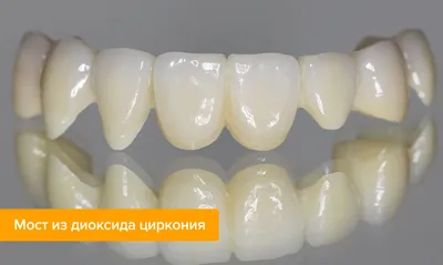 Коронки из диоксида циркония в Волжском в клинике «ДАША»