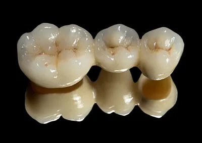Циркониевые коронки по цене керамики на зубы! | Протезирование в  стоматологии Маэстро-Дент