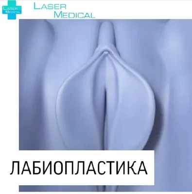 Лабиопластика (коррекция половых губ) - вся информация