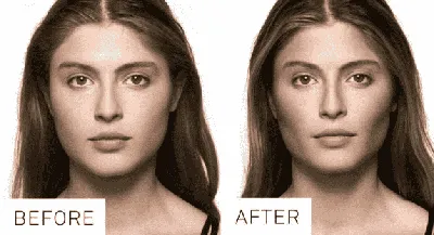 Фото До и После: портфолио и примеры выполненных работ в клинике  косметологии Skin Art