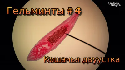 Гельминты # 4. Кошачья двуустка. Описторхоз. | Доктор по соседству | Дзен