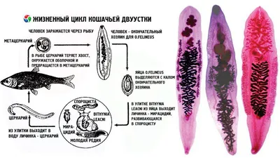 ОПИСТОРХОЗ