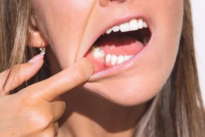 Костная ткань зуба фото фотографии