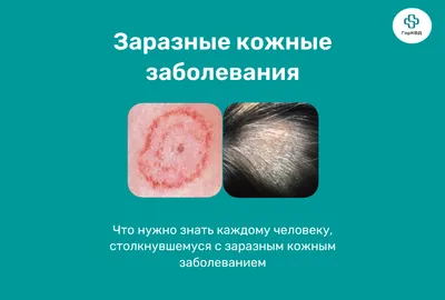 В колбасе находят африканскую чуму свиней — чем это опасно - 26 сентября  2023 - НГС.ру