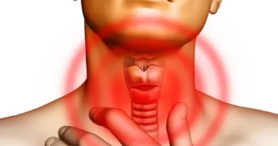 Гипотериоз - нехватка гормонов щитовидной железы | MC Plus