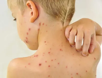 Детские кожные заболевания: фото и симптомы