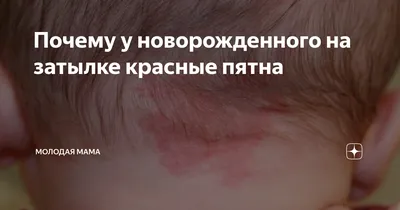 Красное пятно на лбу у новорожденного фото фотографии