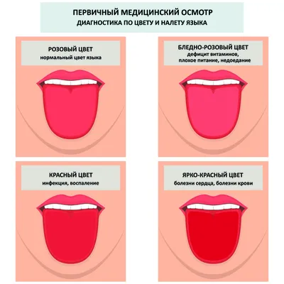 Пятна на языке нужна помощь Форум