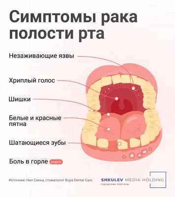 Воспаление слизистой оболочки во рту под языком: причины, симптомы, лечение
