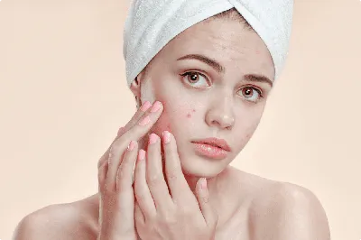 Причины стрессовой сыпи на лице и теле, высыпания на коже при стрессе