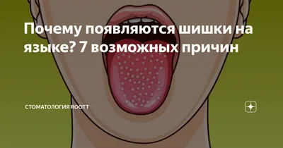 Почему появляются шишки на языке? 7 возможных причин | Стоматология ROOTT |  Дзен