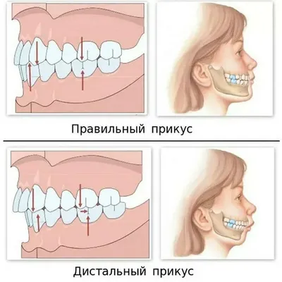 Какую диагностику лучше проводить, чтобы исправить прикус. Рекомендации  ТОП1 ортодонт центра Москвы клиника Ортодонтика