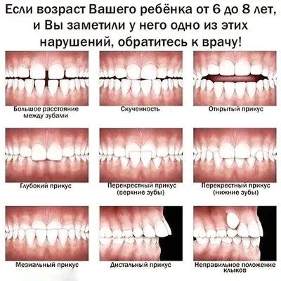 Исправление прикуса в Москве - сколько стоит исправить прикус