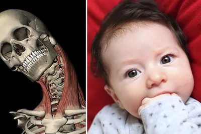 У ребенка голова повернута на одну сторону: что такое кривошея и чем она  опасна для малыша | О детском здоровье: с врачебного на родительский | Дзен