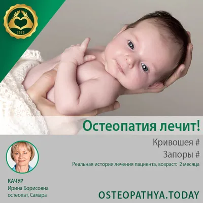 Кривошея. Профилактика и лечение.. Статьи компании «MedMarket»