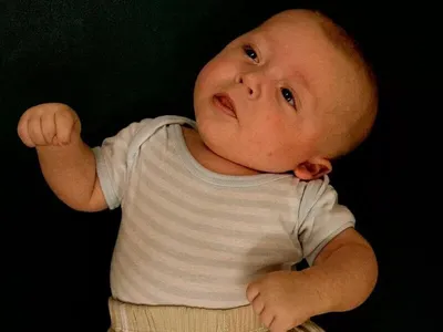 Кривошея у новорожденного ребенка – патологическое состояние врожденного  или приобретенного характера, при котором наблюдается отклонение… |  Instagram