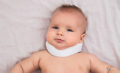 КРИВОШИЯ у немовлят😇 Досить розповсюдженна проблема опорно-рухового  апарату у немовлят. Ознака, за якою визначається кривошия у немовлят – … |  Instagram