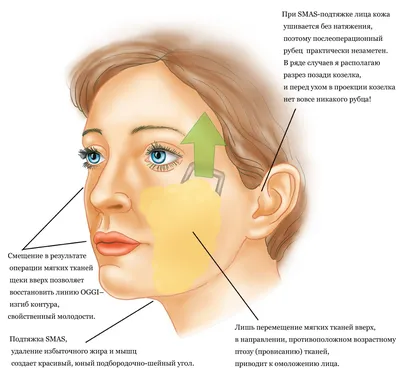 Подтяжка лица | Без операции и боли | Круговая подтяжка