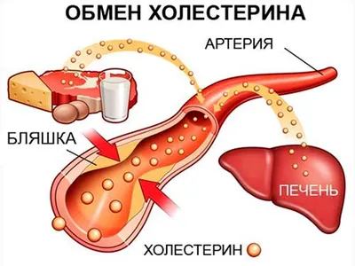 Ксантома: виды и лечение в МЦ Лазерсвiт