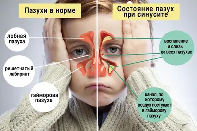 Рентген пазух носа - цена, сделать рентген пазух носа в Москве в  «СМ-Клиника»