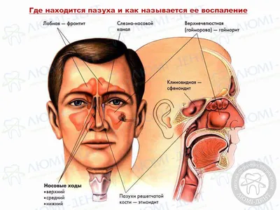 Зубарева А.А. «Диагностика полости носа и околоносовых пазух по данным  КЛКТ» - YouTube