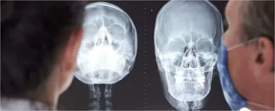 КТ головного мозга и головы в Каменском в клинике «Медикум», Запишитесь на  прием